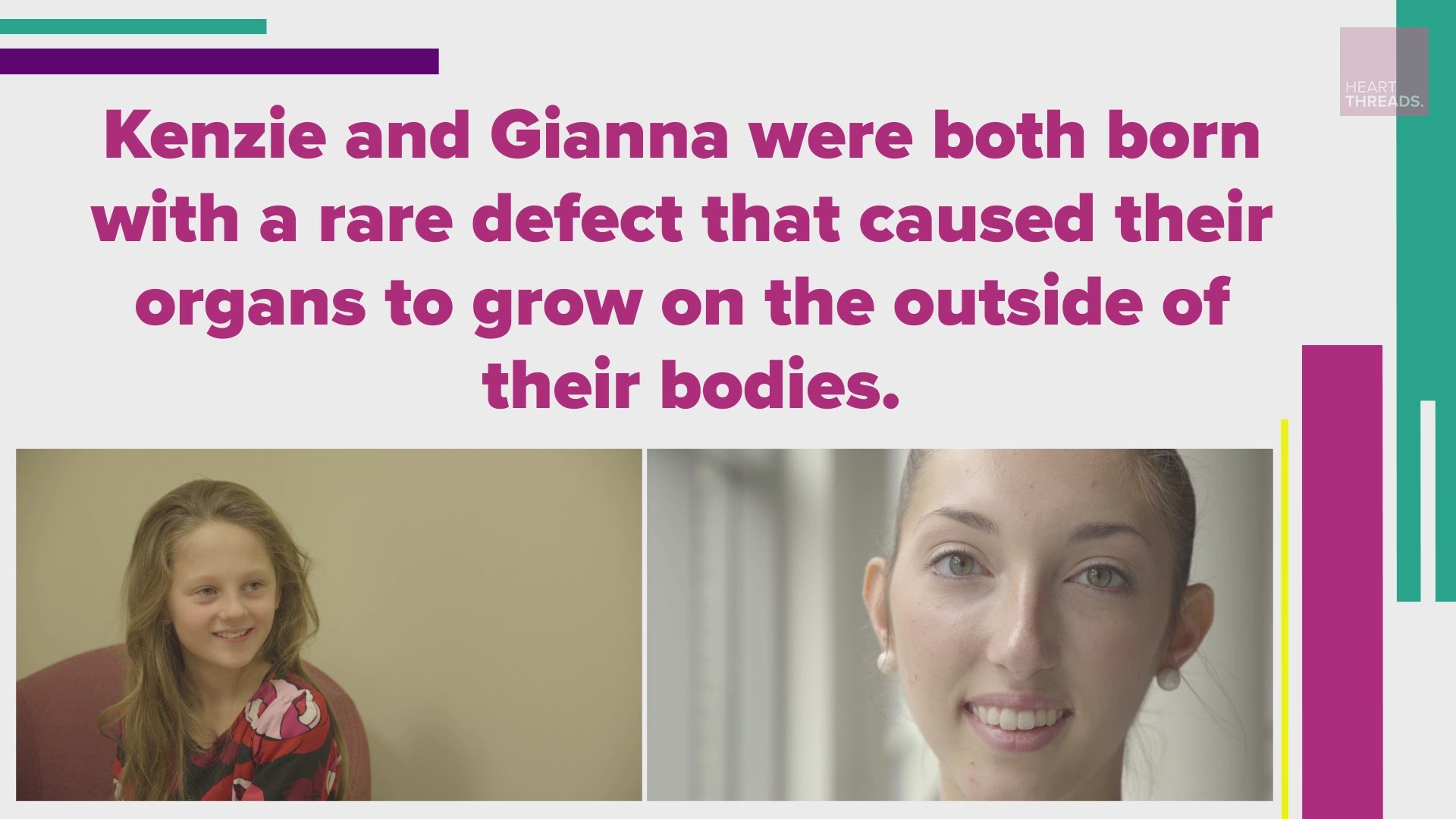 When nine-year-old Kenzie caught wind of Gianna’s story, she knew she had to meet the powerful dancer who shared the same rare birth defect.