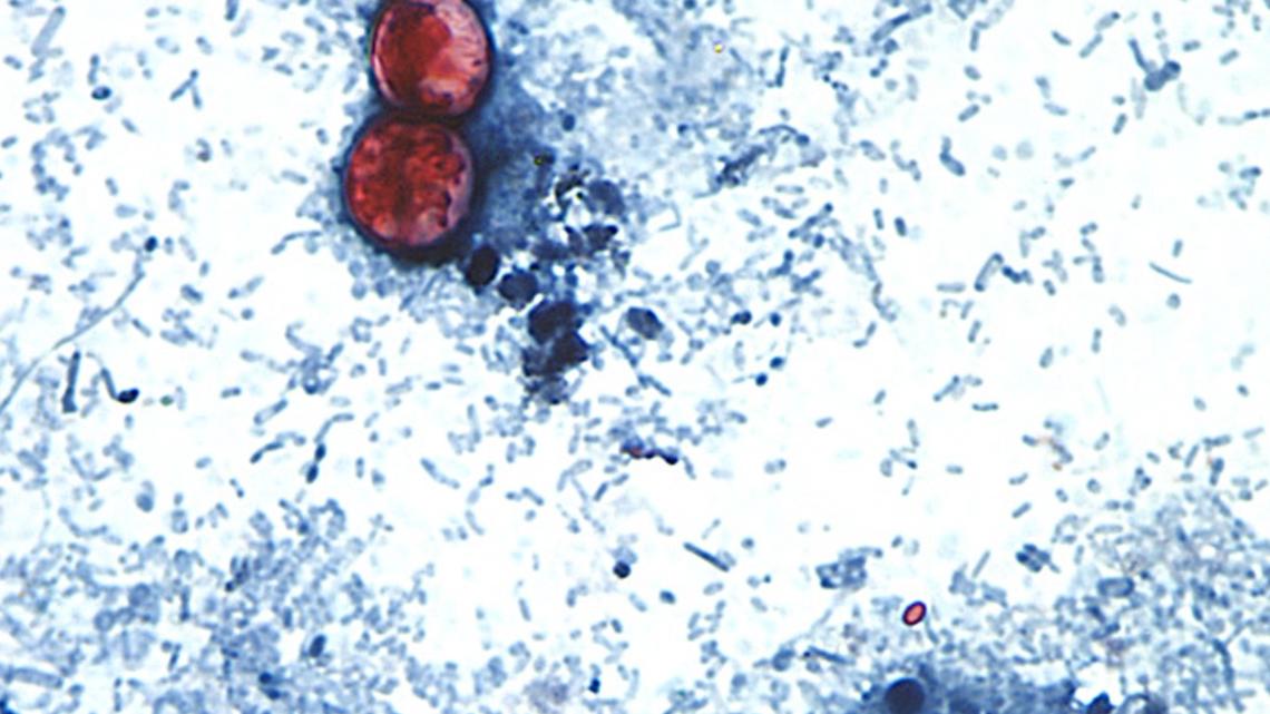 What foods are the source of the cyclosporiasis outbreak? Data points to potential culprit