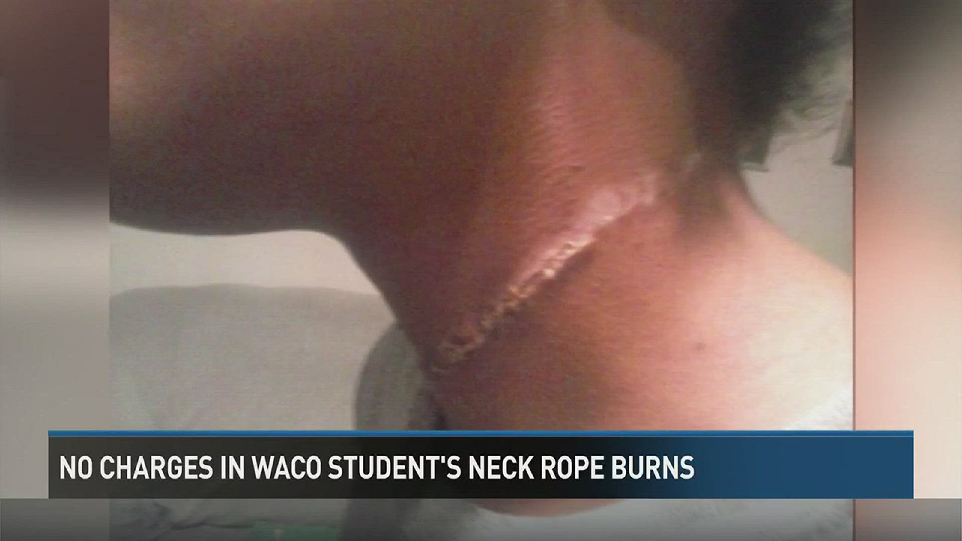 No charges filed in case involving Waco girl with rope burns to neck