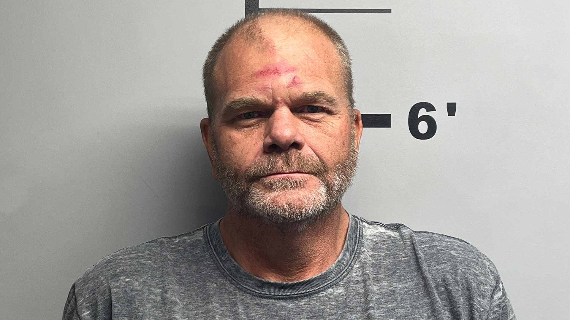 Hyatt is awaiting trial scheduled later this year in his Medicaid fraud case.