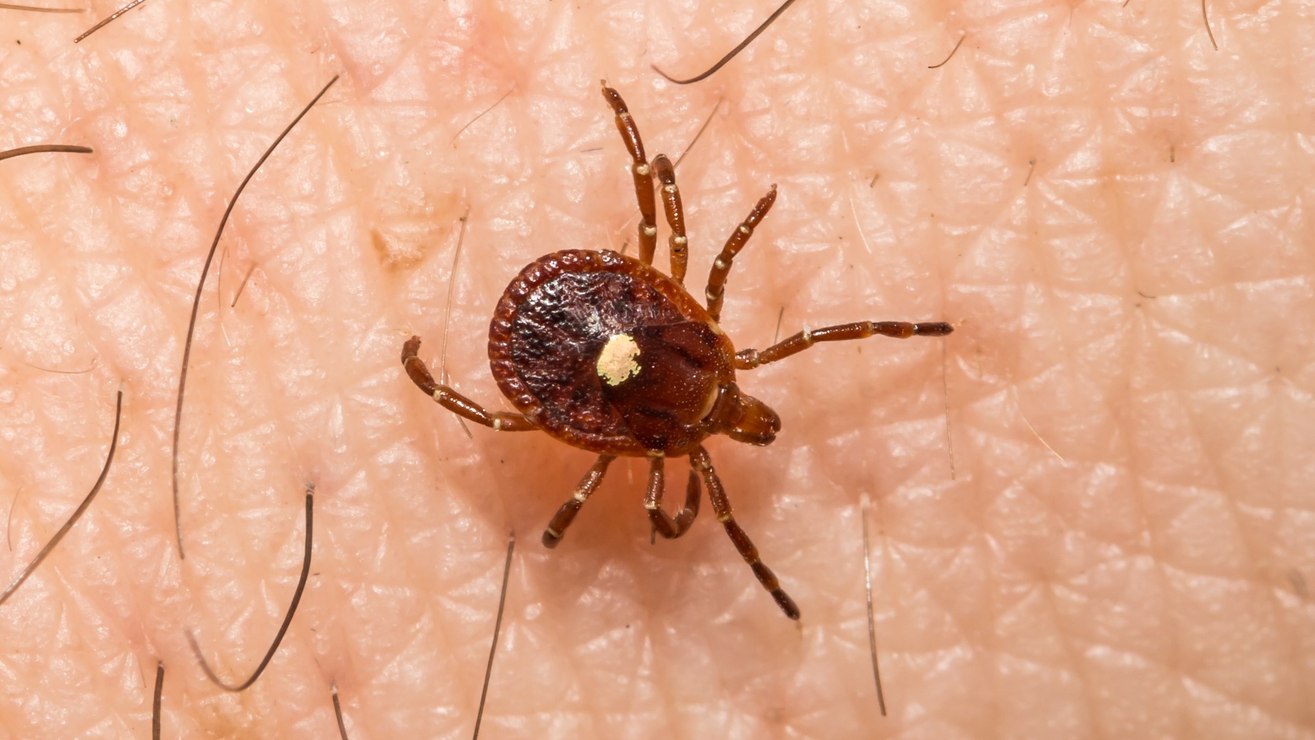 Alpha-gal syndrome is a delayed allergy that starts after a tick bite, according to the Arkansas Department of Health.