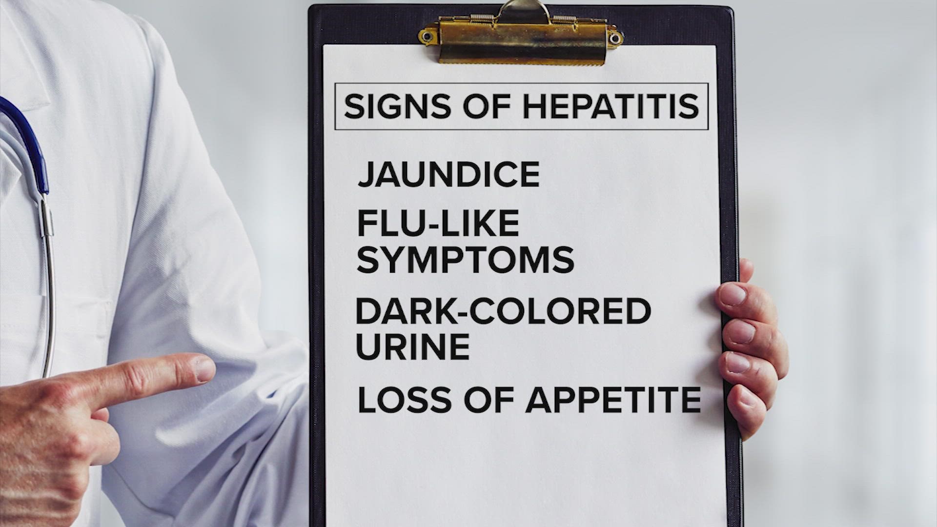 Signs of hepatitis include jaundice – the yellowing of the skin, or whites of the eyes – dark-colored urine, flu-like symptoms, and loss of appetite.