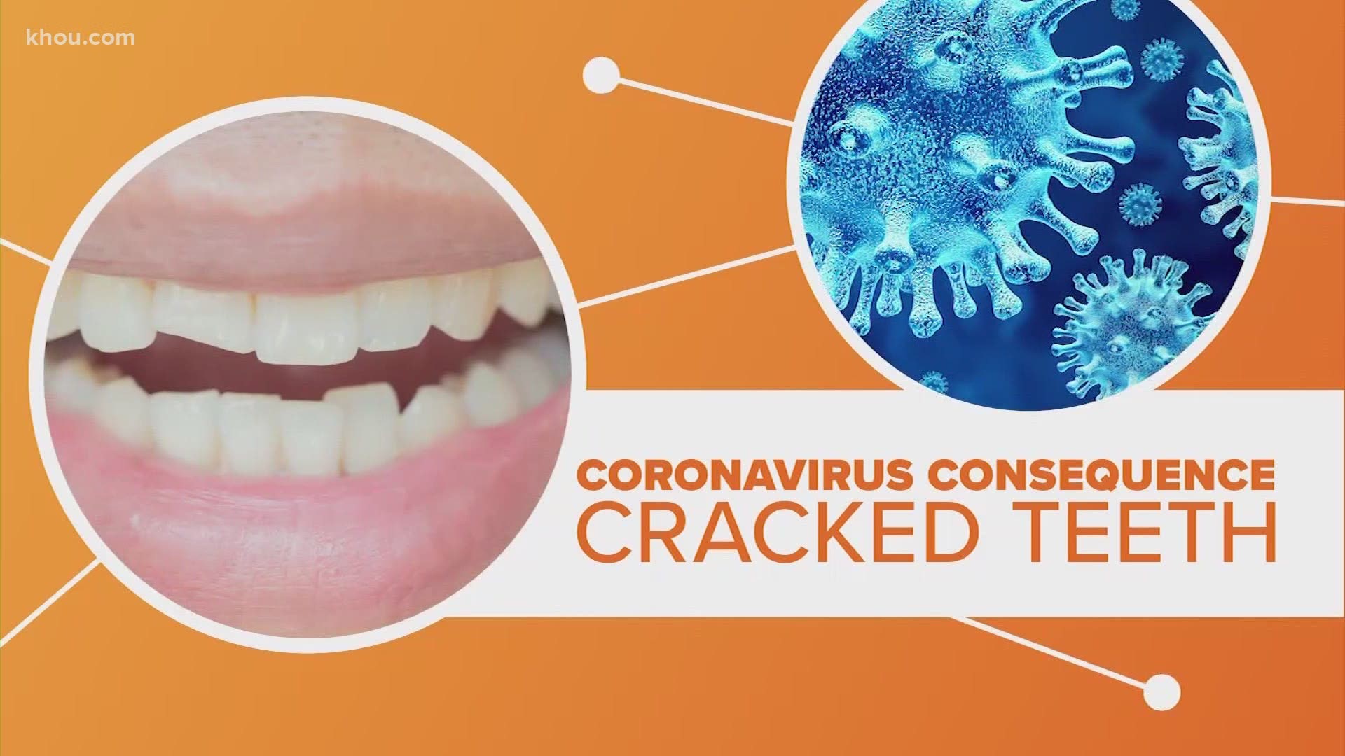 We are seeing some strange consequences from the coronavirus pandemic and that apparently includes more cracked teeth. Let's connect the dots.