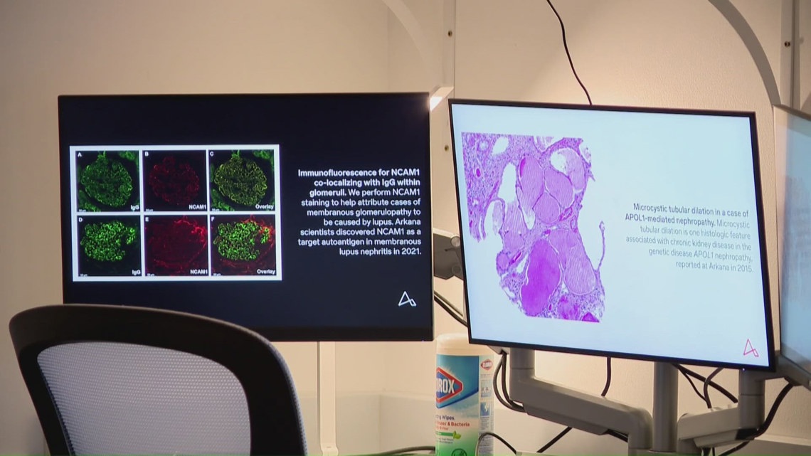 Arkana Lab reopens after multi-million dollar renovation | What it means for patient care