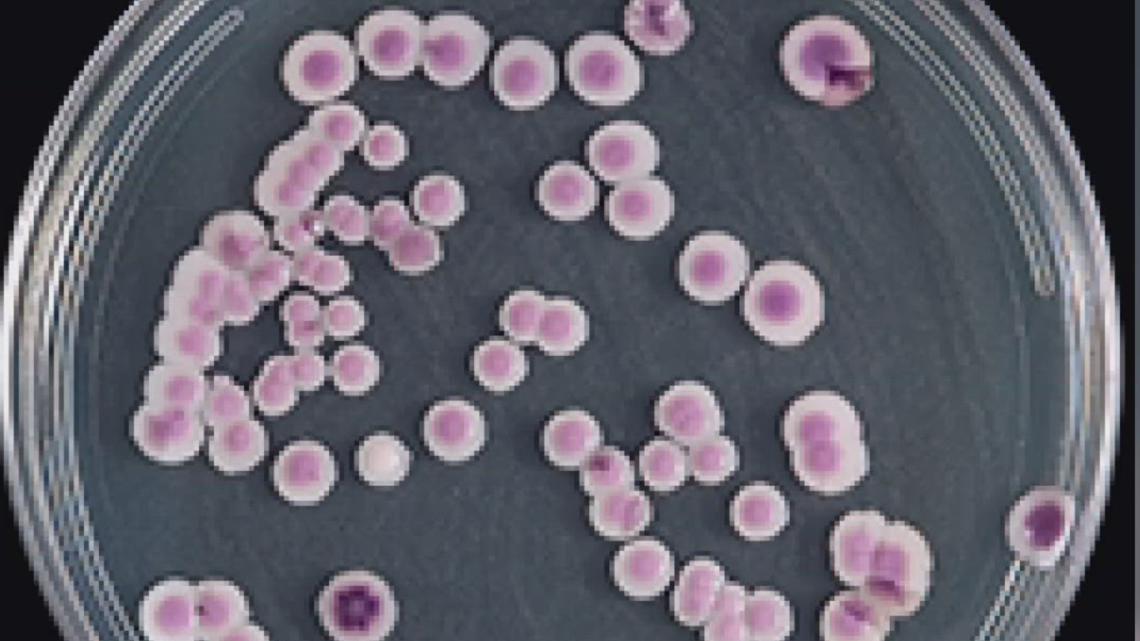 No cases of Candida Auris in Arkansas, officials say