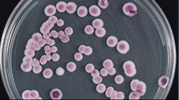 No cases of Candida Auris in Arkansas as it rapidly spreads through country