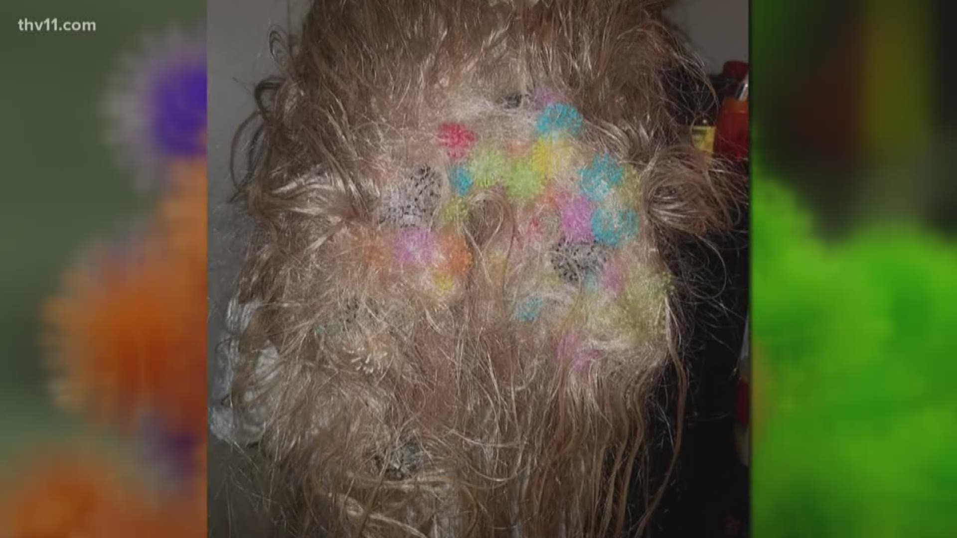 Arkansas mom warns parents about 'Bunchems' after daughter gets 50 tangled  in hair