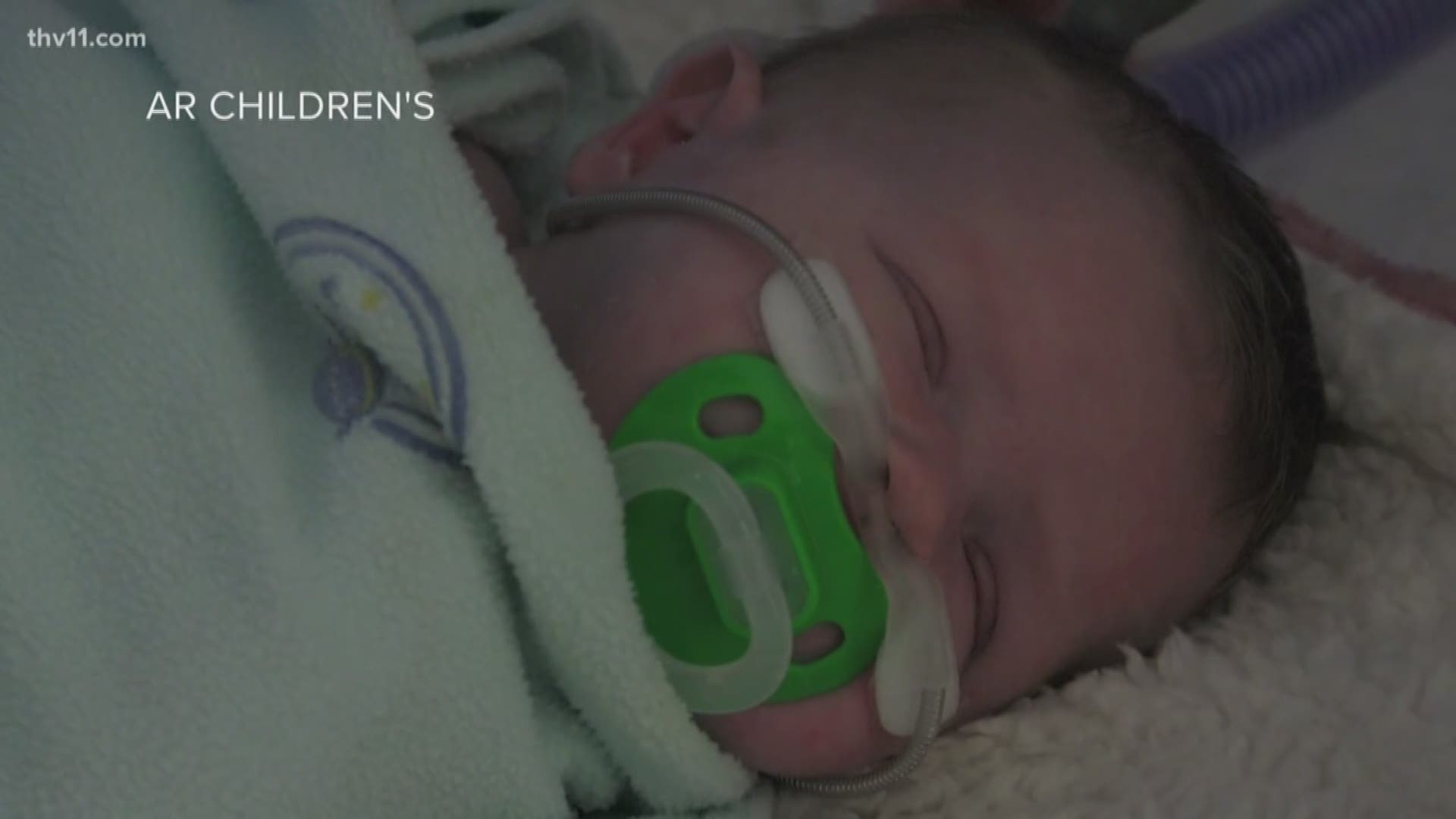 Arkansas Children's Hospital is seeing a major increase in the amount of RSV cases this year.