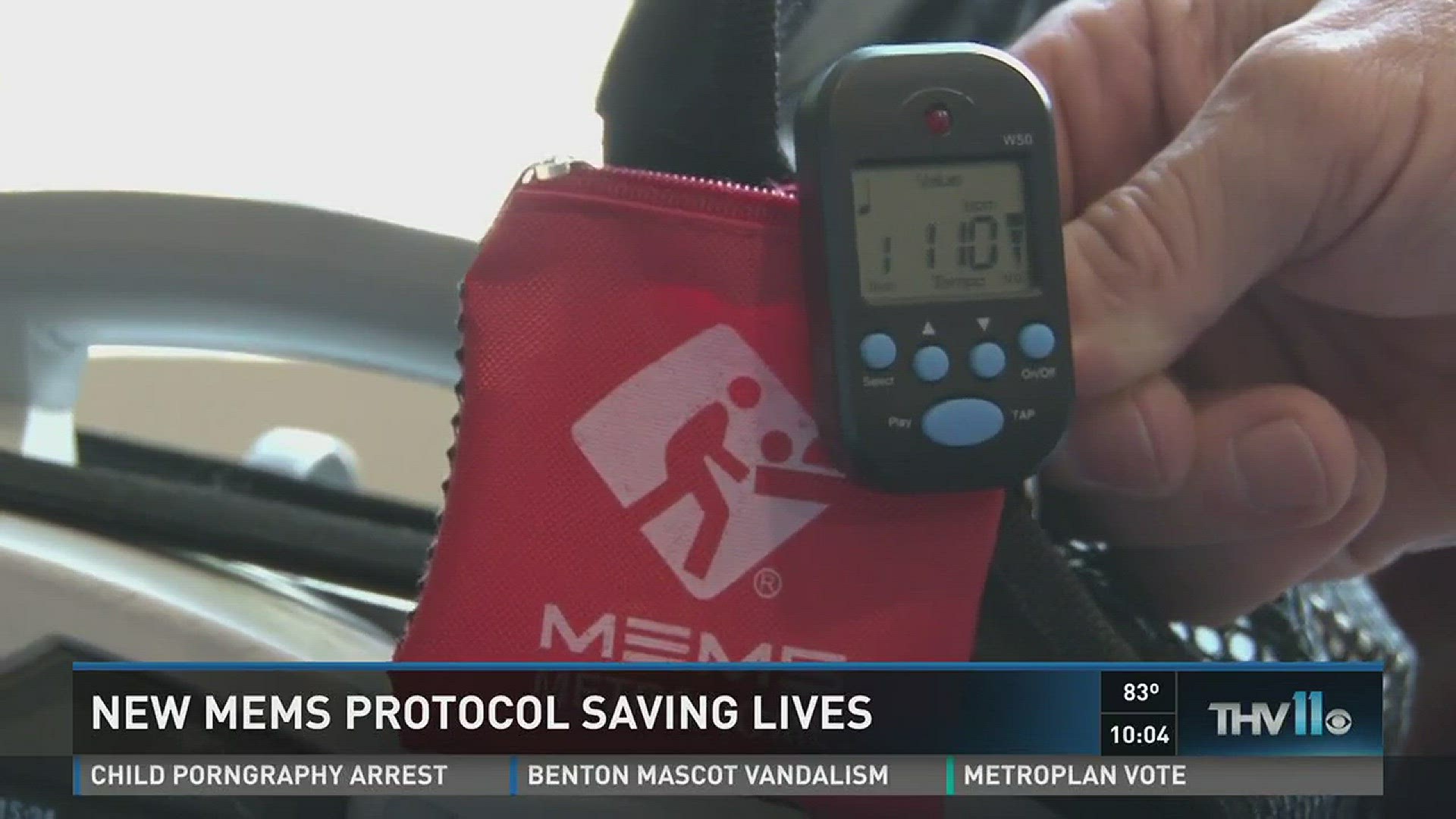 New MEMS protocol saving lives