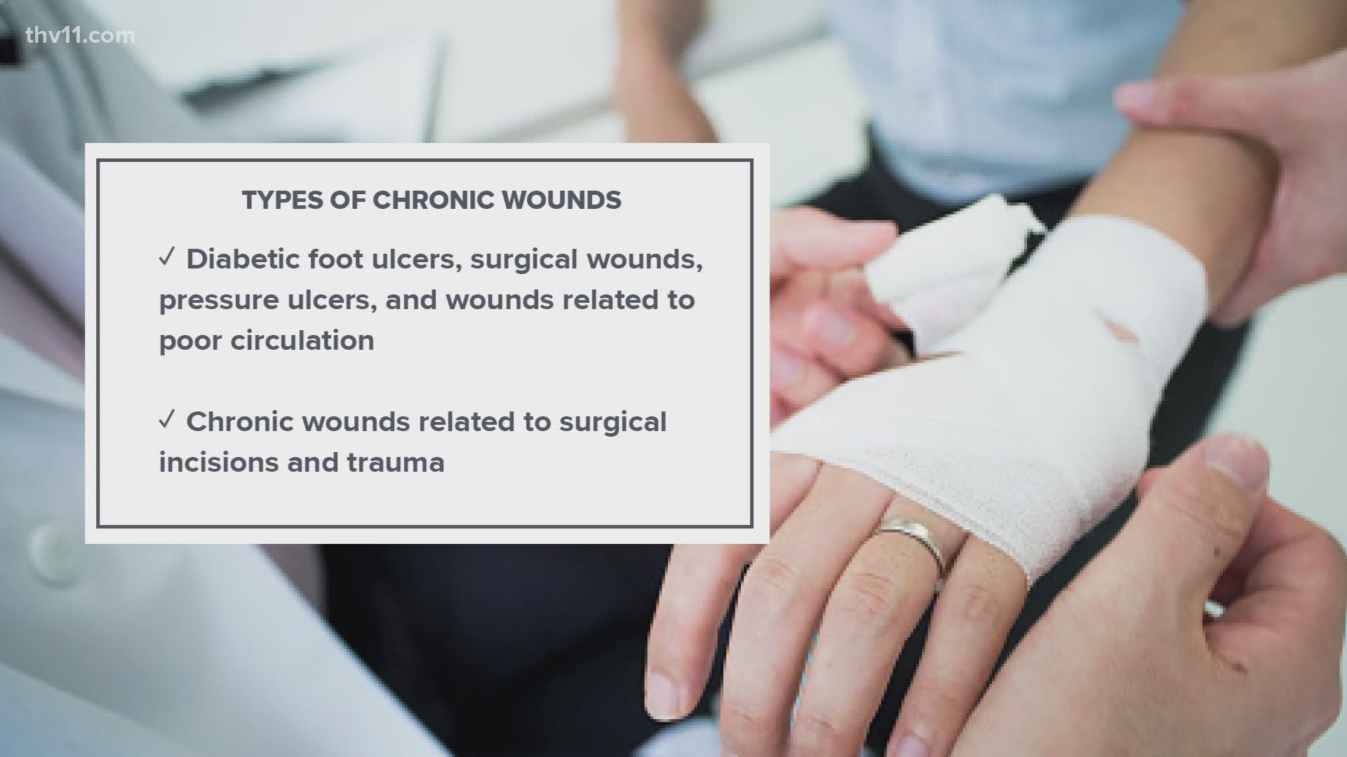 Caring for wounds at Pain Treatment Centers of America