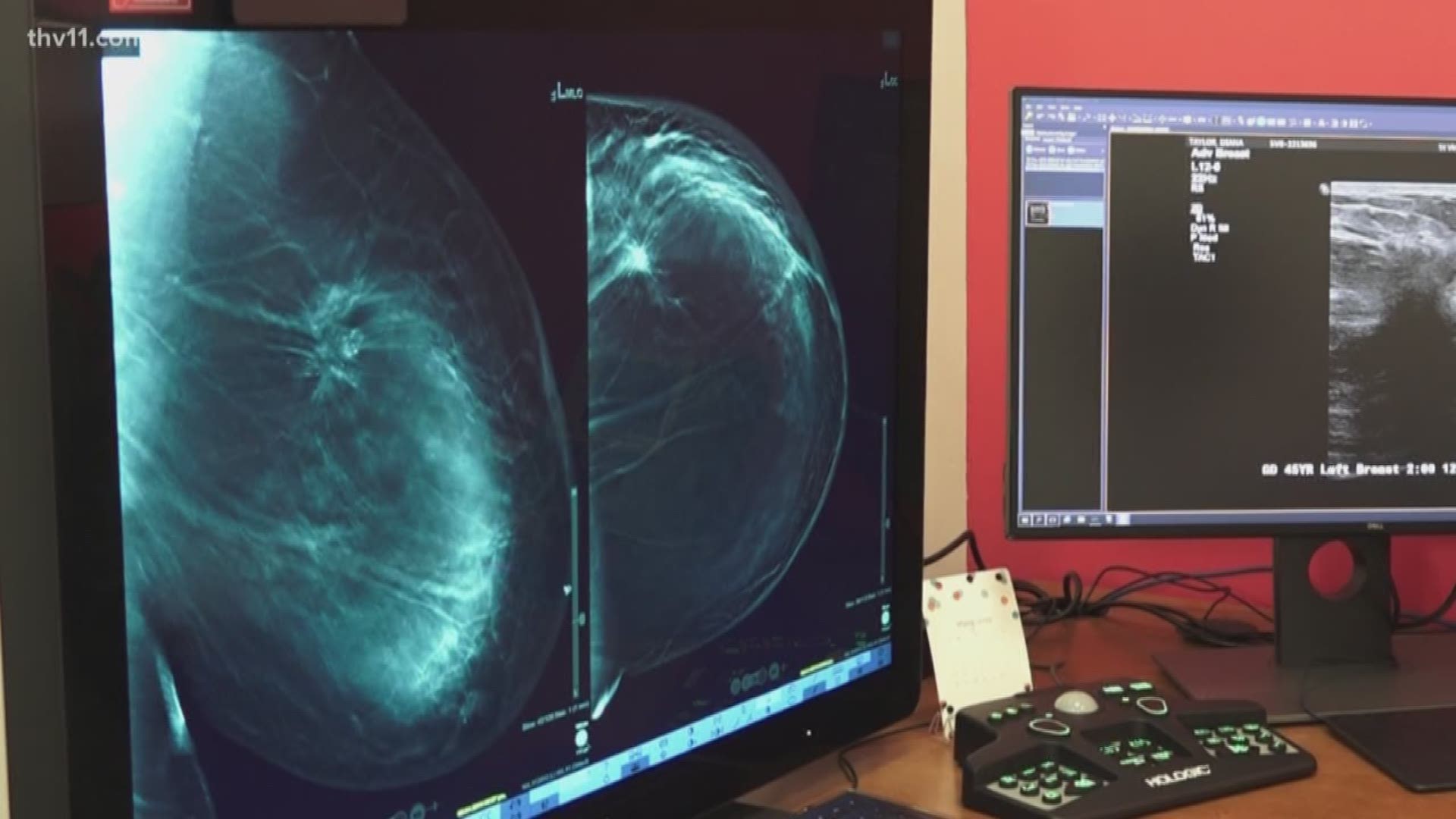 A new breast center opening in Little Rock's CARTI cancer cancer is hoping to make a major difference for women in the state even helping to save more lives through advanced technology and early diagnostics.