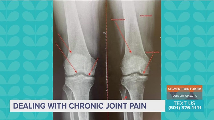 Common causes of chronic joint pain