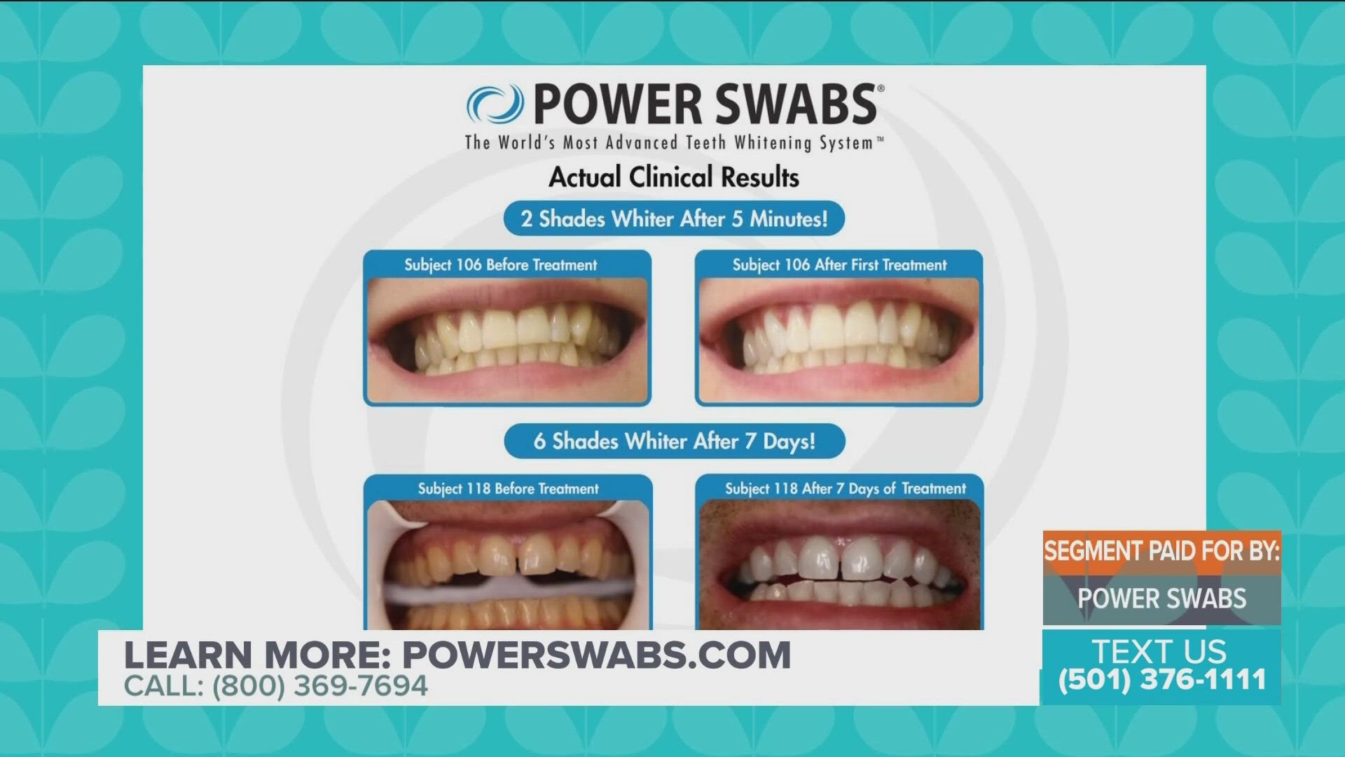 Power Swabs Teeth Whitening System offers a 50% off with free shipping and a quick stick.