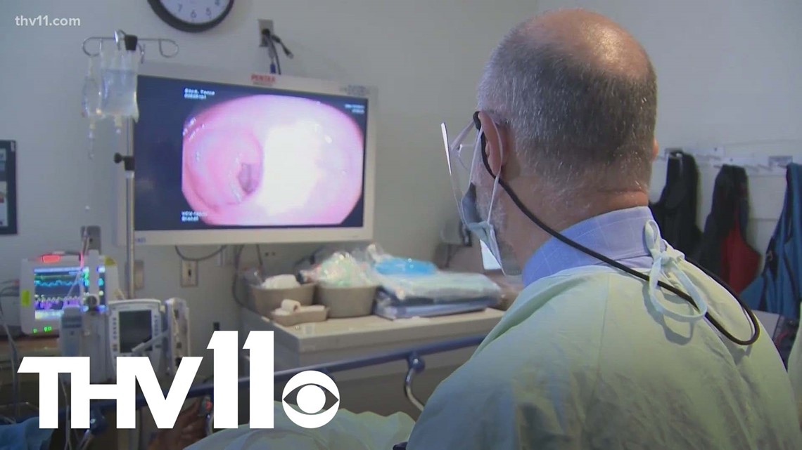 Colon cancer being diagnosed in younger adults