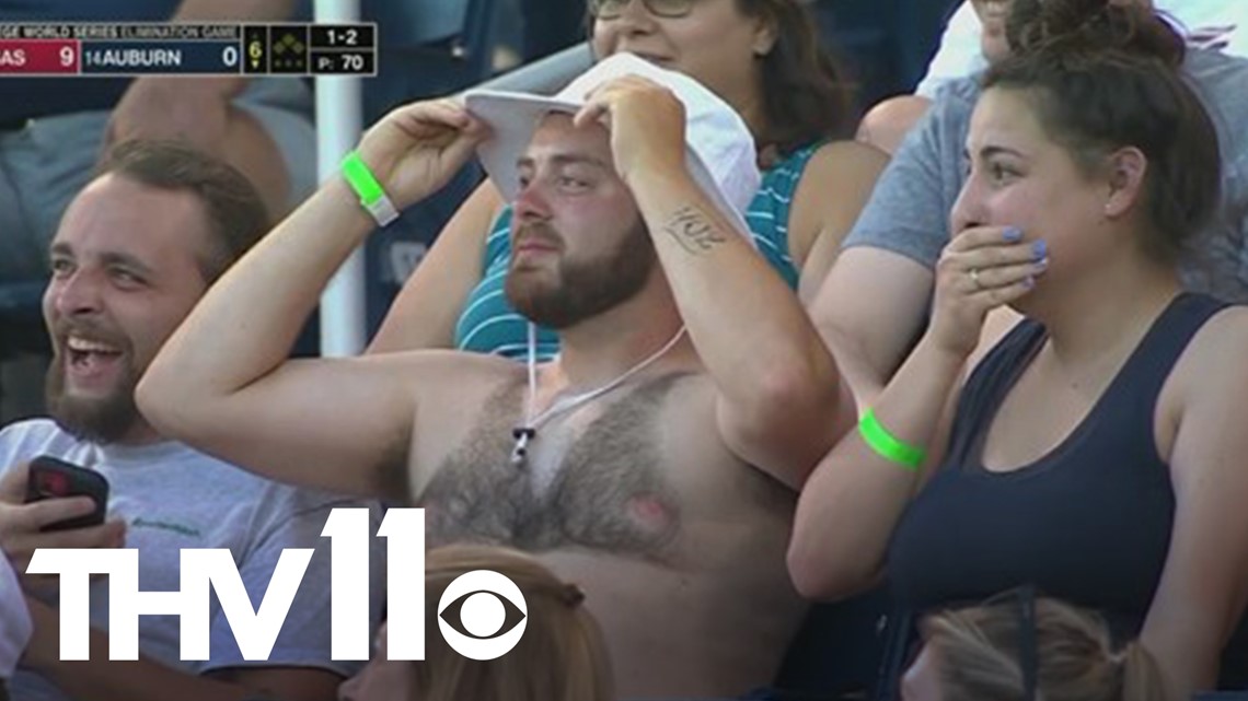 Baseball fan shaves chest hair in shape of bikini top