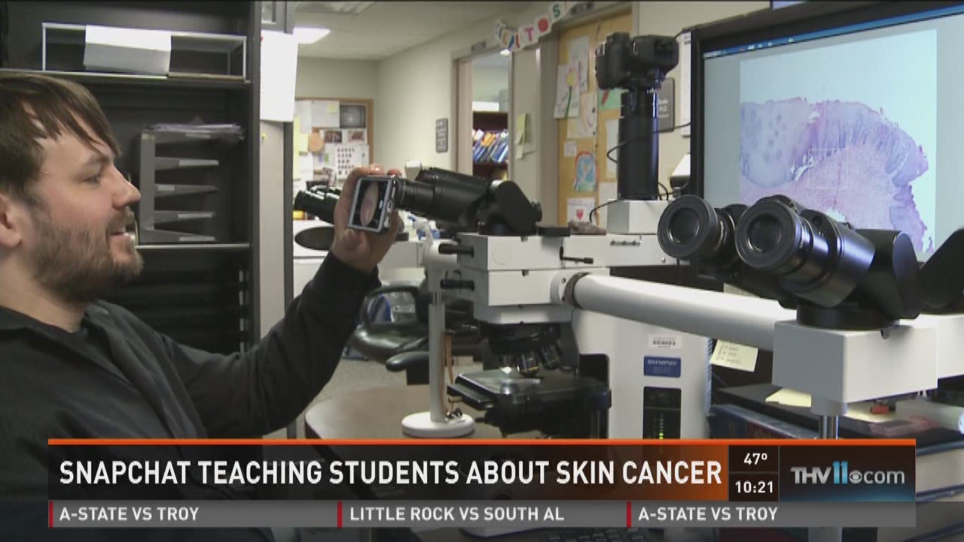 Snapchat teaching students about skin cancer