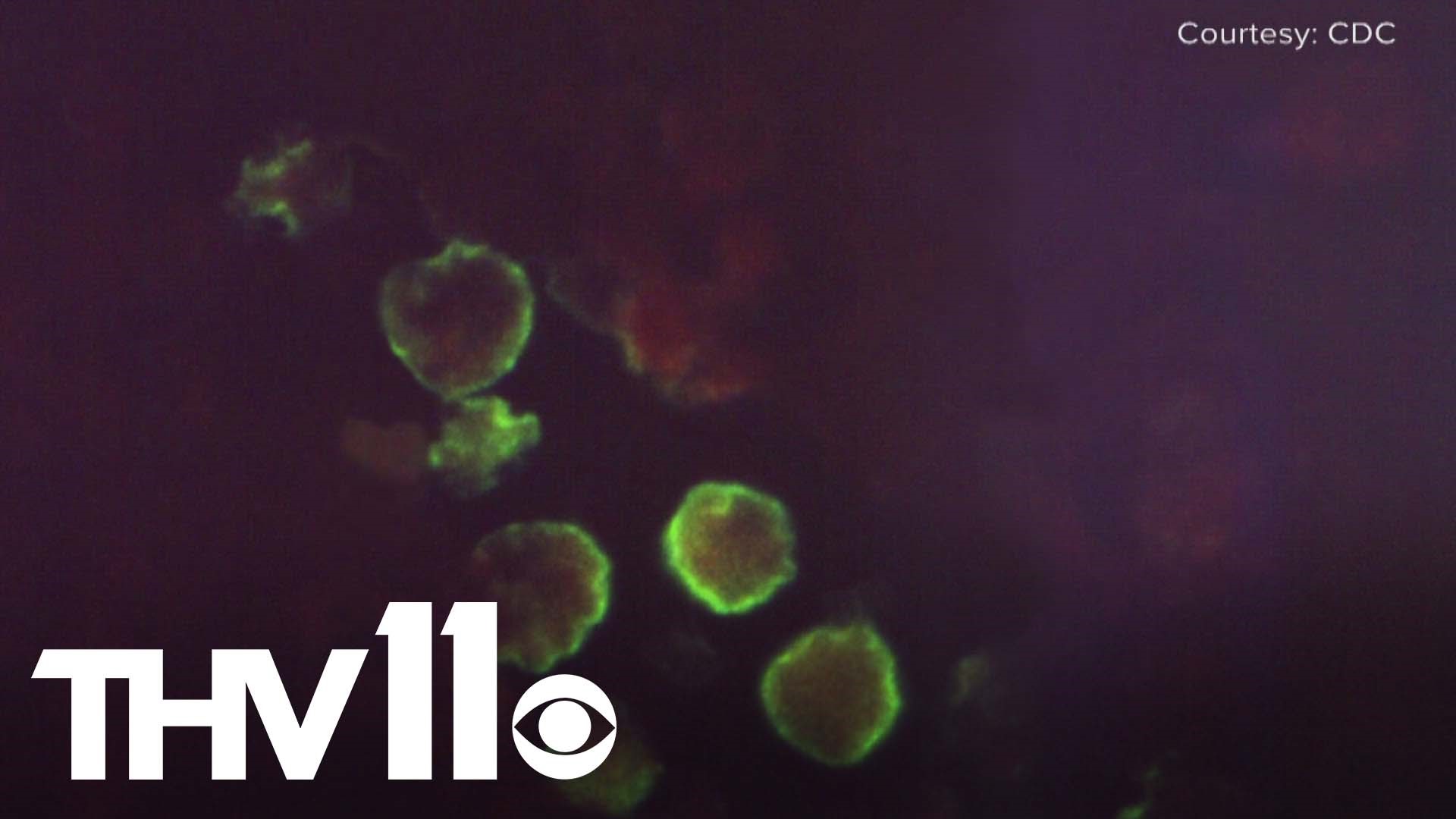 We're learning more about what led up to a child's death after they were exposed to a rare, brain-eating amoeba at the Country Club of Little Rock.