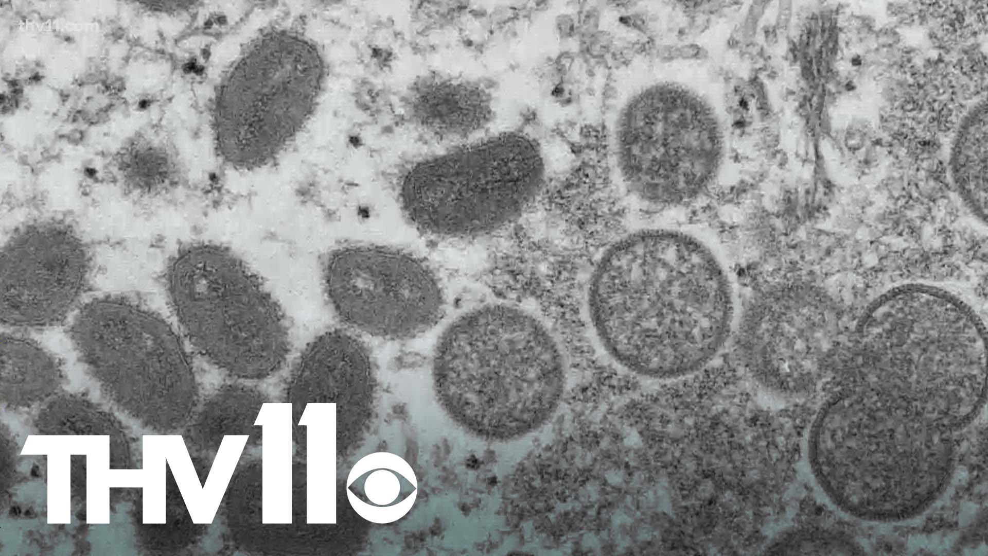In less than a month, a new monkeypox outbreak has spread rapidly across the world. It's now in the U.S., and Arkansas health officials are preparing.