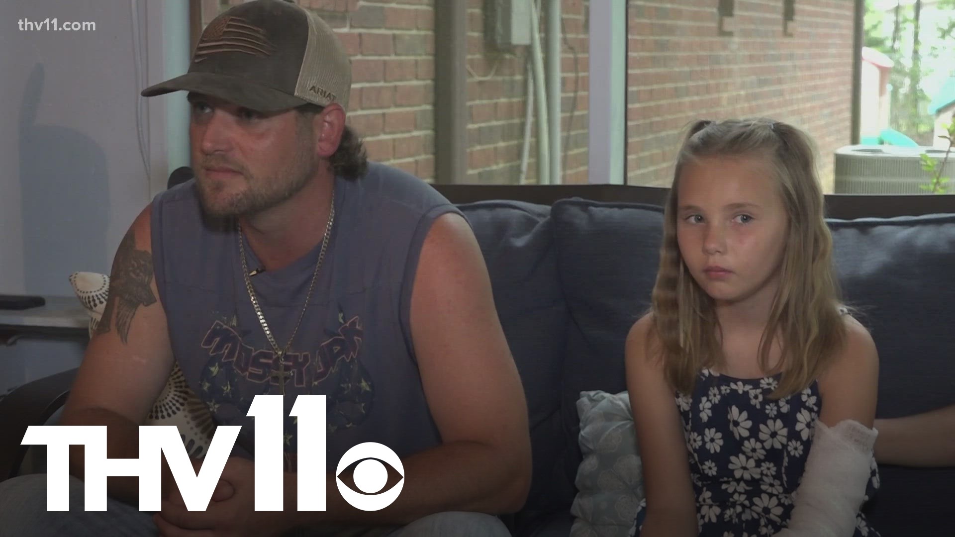 Nothing says Happy Fourth of July like fireworks, but using them comes with risks. One Redfield family is trying to spread that message after dealing with an injury.