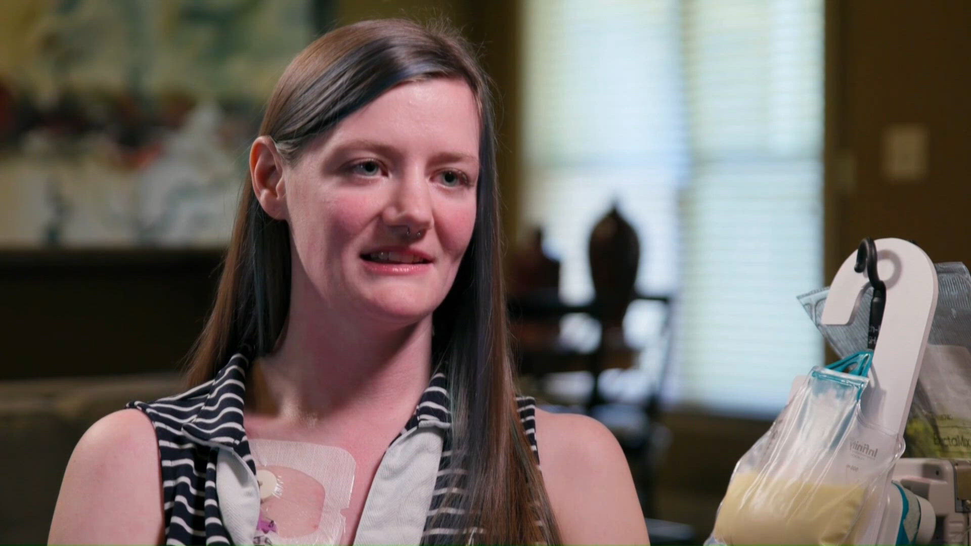 Arkansas woman shares what it's like living with gastroparesis