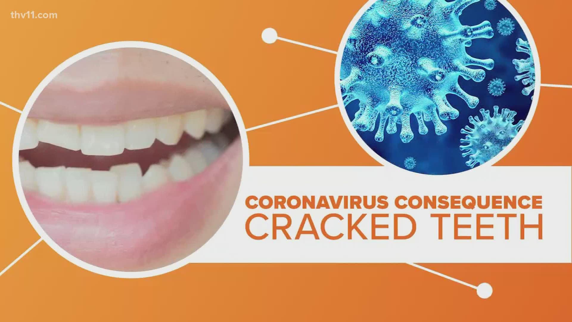 Doctors are now making some strange discoveries about COVID-19 and it's happening with our teeth.