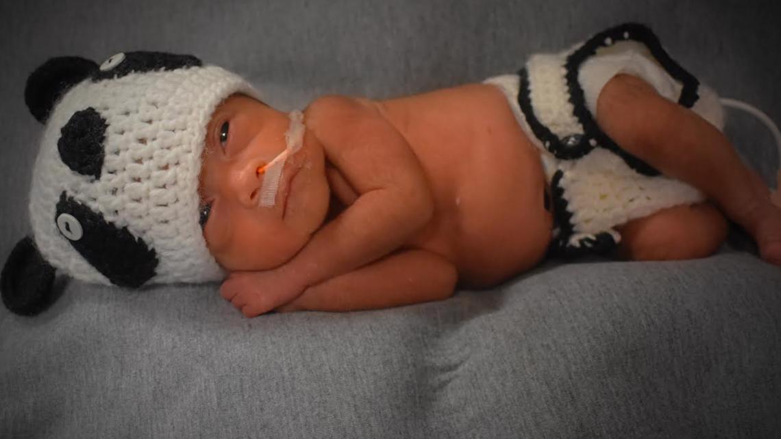 baby coming out of stomach costume