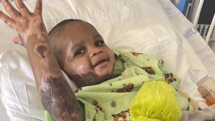 Georgia baby burned in freak accident returns home